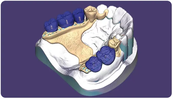 Yazılım Çözümleri